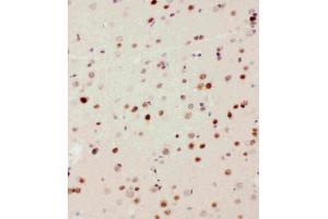 Anti-MEKK3 antibody, IHC(P): Rat Brain Tissue (MAP3K3 antibody  (N-Term))