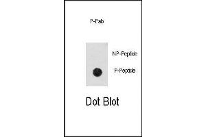 Image no. 1 for anti-Cyclin-Dependent Kinase 2 (CDK2) (pThr14) antibody (ABIN358539) (CDK2 antibody  (pThr14))