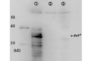 Western Blotting (WB) image for anti-Prion Protein (PRNP) antibody (ABIN2452081) (PRNP antibody)