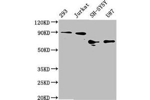 Western Blot Positive WB detected in: 293 whole cell lysate, Jurkat whole cell lysate, SH-SY5Y whole cell lysate, U87 whole cell lysate All lanes: FOXO3A antibody at 1. (Recombinant FOXO3 antibody)