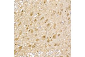 Immunohistochemistry of paraffin-embedded mouse spinal cord using PSM Rabbit pAb (752) at dilution of 1:50 (40x lens).