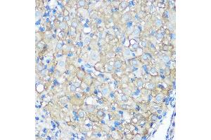 Immunohistochemistry of paraffin-embedded rat ovary using CD23 Rabbit mAb (ABIN7267160) at dilution of 1:100 (40x lens). (FCER2 antibody)