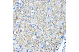 Immunohistochemistry of paraffin-embedded rat ovary using CD23 Rabbit mAb (ABIN7267160) at dilution of 1:100 (40x lens).