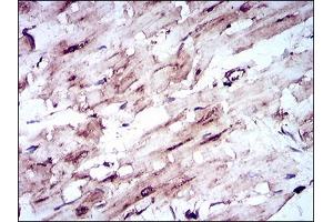 Immunohistochemical analysis of paraffin-embedded cardiac muscle tissues using SLC2A4 mouse mAb with DAB staining.