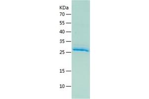 SDS-PAGE (SDS) image for Epiregulin (EREG) (AA 60-108) protein (His-IF2DI Tag) (ABIN7284326) (Epiregulin Protein (EREG) (AA 60-108) (His-IF2DI Tag))