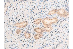 ABIN6267269 at 1/100 staining rat uterine tissue sections by IHC-P. (EGFR antibody  (pSer1071))