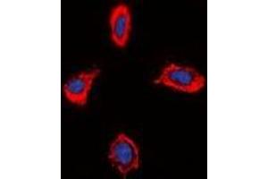 Immunofluorescent analysis of Alpha-1D Adrenergic Receptor staining in MCF7 cells. (ADRA1D antibody  (C-Term))