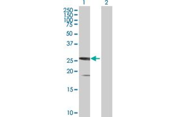 SSX5 Antikörper  (AA 1-229)