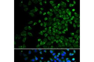 Immunofluorescence analysis of HeLa cells using BAK1 Polyclonal Antibody (BAK1 antibody)