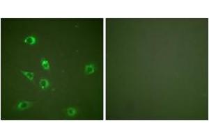 Immunofluorescence analysis of NIH-3T3 cells, using Glucagon Antibody. (Glucagon antibody  (AA 61-110))