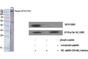 Western Blot (WB) analysis of specific cells using Phospho-IGF-IR (Y1161) Polyclonal Antibody. (IGF1R antibody  (pTyr1161))