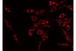 ABIN6274132 staining COLO205 by IF/ICC. (TNFSF15 antibody  (C-Term))