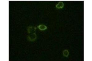 Immunofluorescence staining of methanol-fixed Hela cells using ABL2 antibody showing cytoplasm localization. (ABL2 antibody)