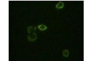 Immunofluorescence staining of methanol-fixed Hela cells using ABL2 antibody showing cytoplasm localization. (ABL2 antibody)