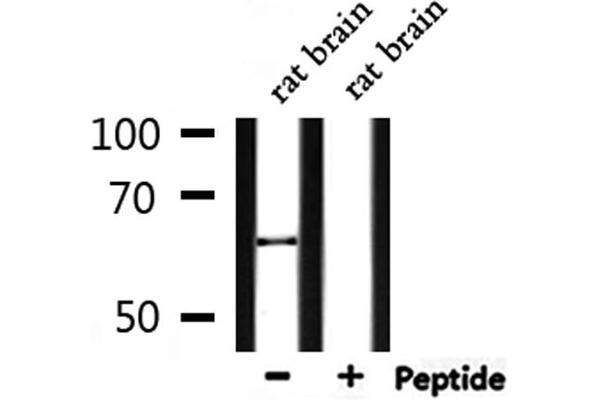 MMP14 antibody  (C-Term)