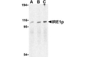 Image no. 1 for anti-Endoplasmic Reticulum To Nucleus Signaling 1 (ERN1) (C-Term) antibody (ABIN318702) (ERN1 antibody  (C-Term))