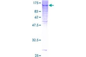 Image no. 1 for General Transcription Factor IIIC, Polypeptide 2, beta 110kDa (GTF3C2) (AA 1-911) protein (GST tag) (ABIN1306169) (GTF3C2 Protein (AA 1-911) (GST tag))