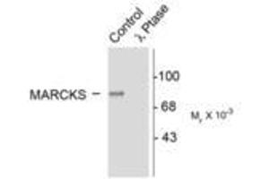 Image no. 1 for anti-Myristoylated Alanine-Rich Protein Kinase C Substrate (MARCKS) (pSer152), (Ser156) antibody (ABIN227290) (MARCKS antibody  (pSer152, Ser156))
