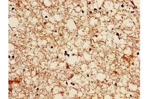 Immunohistochemistry of paraffin-embedded human brain tissue using ABIN7145700 at dilution of 1:100 (BMP7 antibody  (AA 293-431))