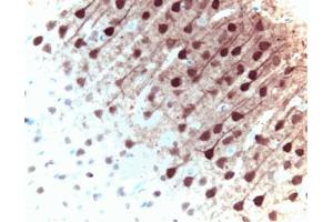 Immunohistochemical staining of ERK1 in pyrimidal cells from the rat cortex: formalin-fixed paraffin-embedded tissue, with citrate pre-treatment (40X magnification). (ERK1 antibody  (AA 325-345))
