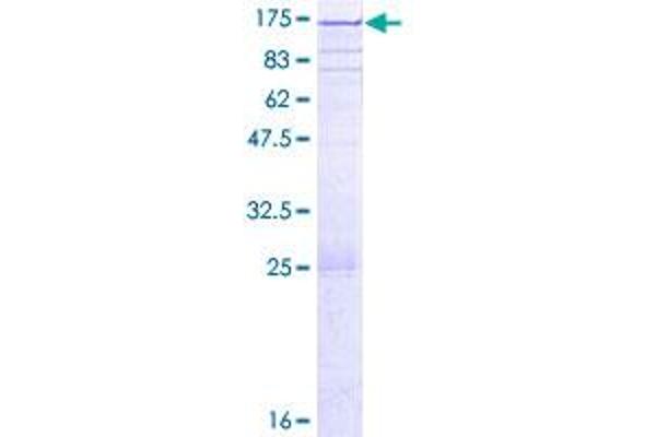 PARG Protein (PARG) (AA 1-976) (GST tag)