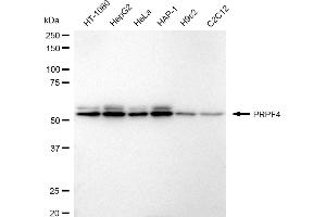 Western blotting analysis using PRPF4 antibody (ABIN7800056). (Recombinant PRPF4 antibody)