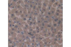 Used in DAB staining on fromalin fixed paraffin- embedded liver tissue (LDLR antibody)