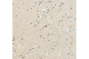 anti-Deleted in Colorectal Carcinoma (DCC) (AA 851-1447) antibody