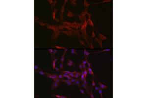 Immunofluorescence analysis of PC-12 cells using GSDMD (Full Length+C terminal) Rabbit pAb (ABIN7267350) at dilution of 1:250 (40x lens). (GSDMD antibody  (AA 276-484))