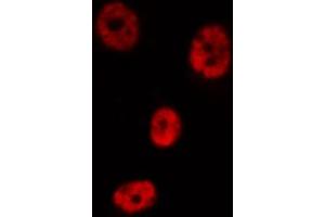 Immunofluorescence (fixed cells) (IF/ICC) image for anti-Nuclear Factor-kB p65 (NFkBP65) (pThr435) antibody (ABIN6255688)