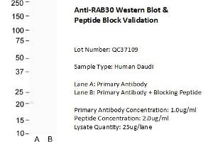 Host: Rabbit Target Name: RAB30 Sample Type: Human Daudi Lane A: Primary Antibody  Lane B: Primary Antibody + Blocking Peptide  Primary Antibody Concentration: 1. (RAB30 antibody  (C-Term))
