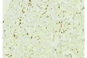 ABIN6276544 at 1/100 staining Mouse muscle tissue by IHC-P. (TCF4 antibody  (N-Term))
