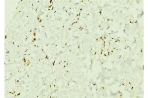ABIN6276544 at 1/100 staining Mouse muscle tissue by IHC-P.