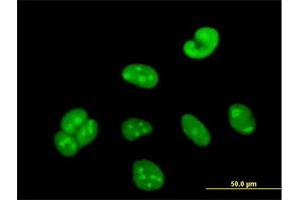 Immunofluorescence of purified MaxPab antibody to WBSCR22 on HeLa cell.
