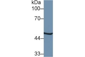 Detection of PSMC2 in Mouse Liver lysate using Polyclonal Antibody to Proteasome 26S Subunit, ATPase 2 (PSMC2) (PSMC2 antibody  (AA 1-433))