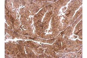 IHC-P Image DMPK antibody detects DMPK protein at membrane on mouse prostate by immunohistochemical analysis. (DMPK antibody  (Center))