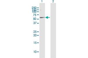 Western Blot analysis of SERPINA1 expression in transfected 293T cell line by SERPINA1 MaxPab polyclonal antibody. (SERPINA1 antibody  (AA 1-418))