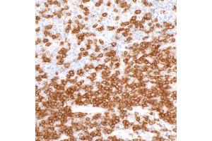 Immunohistochemistry (IHC) image for anti-CD3 epsilon (CD3E) (AA 157-207) antibody (ABIN7454035) (Recombinant CD3 epsilon antibody  (AA 157-207))