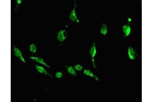 Immunofluorescent analysis of U251 cells using ABIN7149878 at dilution of 1:100 and Alexa Fluor 488-congugated AffiniPure Goat Anti-Rabbit IgG(H+L) (DKK1 antibody  (AA 33-266))