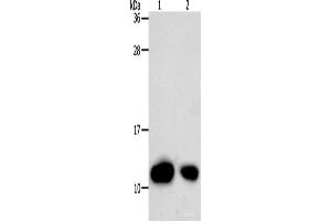 Western Blot analysis of Hela cell and Human liver cancer tissue using TXN Polyclonal Antibody at dilution of 1:700 (TXN antibody)
