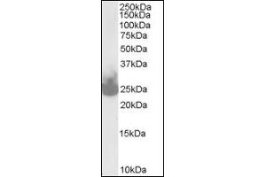 Image no. 1 for anti-Synaptosomal-Associated Protein, 25kDa (SNAP25) (C-Term) antibody (ABIN372760) (SNAP25 antibody  (C-Term))