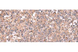 Immunohistochemistry of paraffin-embedded Human tonsil tissue using MAPK8IP3 Polyclonal Antibody at dilution of 1:45(x200) (JIP3 antibody)