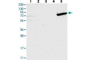 Western blot analysis of Lane 1: RT-4, Lane 2: U-251 MG, Lane 3: Human Plasma, Lane 4: Liver, Lane 5: Tonsil with GBP6 polyclonal antibody . (GBP6 antibody)