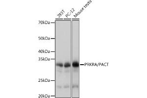 Western blot analysis of extracts of various cell lines, using PRKRA/PACTRabbit mAb (ABIN7269666) at 1:1000 dilution. (PRKRA antibody)
