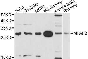 Western blot analysis of extracts of various cell lines, using MFAP2 antibody. (MFAP2 antibody)