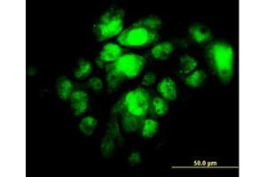 Image no. 2 for anti-Interferon Regulatory Factor 5 (IRF5) antibody (ABIN6745988) (IRF5 antibody)