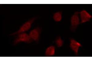 ABIN6269342 staining HT29 by IF/ICC. (PRKAA1 antibody  (C-Term))