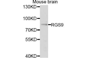 Western blot analysis of extracts of mouse brain cells, using RGS9 antibody. (RGS antibody)