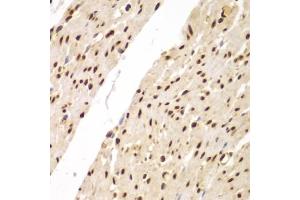 Immunohistochemistry of paraffin-embedded human colon using SUPT20H antibody (ABIN6133386, ABIN6148735, ABIN6148736 and ABIN6223233) at dilution of 1:100 (40x lens). (FAM48A/P38IP antibody  (AA 580-779))