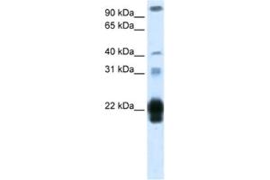 Western Blotting (WB) image for anti-Chorionic Somatomammotropin Hormone 1 (Placental Lactogen) (CSH1) antibody (ABIN2462104)